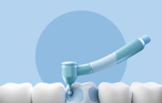 Пломбы в зубах: нужно ли менять?