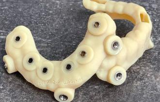 Что такое хирургический шаблон? Преимущества использования