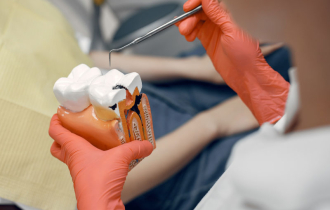 Что такое корневые каналы