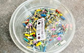 Почему выпадают пломбы из зубов